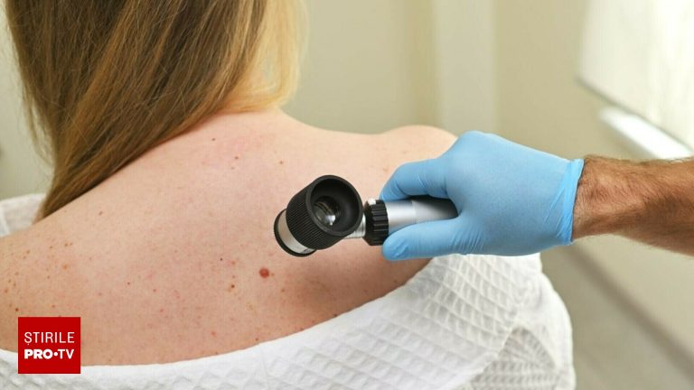 scandal medical in europa 67 de copii risca cancer