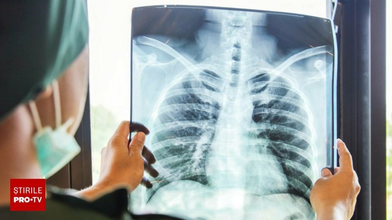 Un barbat din Tanzania a aflat veste socanta la spital