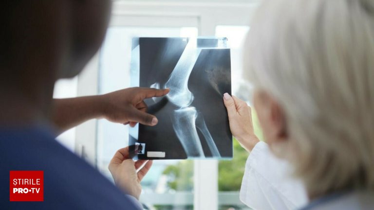 Femeie din Coreea de Sud cu dureri la genunchi gaseste aur la radiografie