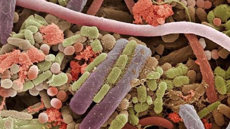 Bacteriile care „devorează” țesuturile au cauzat moartea a cinci persoane în acest an, informează autoritățile. Bacteriile care devoreaza tesuturile au cauzat moartea a cinci persoane in acest an informeaza autoritatile