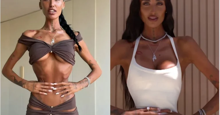 Fracturarea coastelor, noul trend periculos pentru talia de viespe